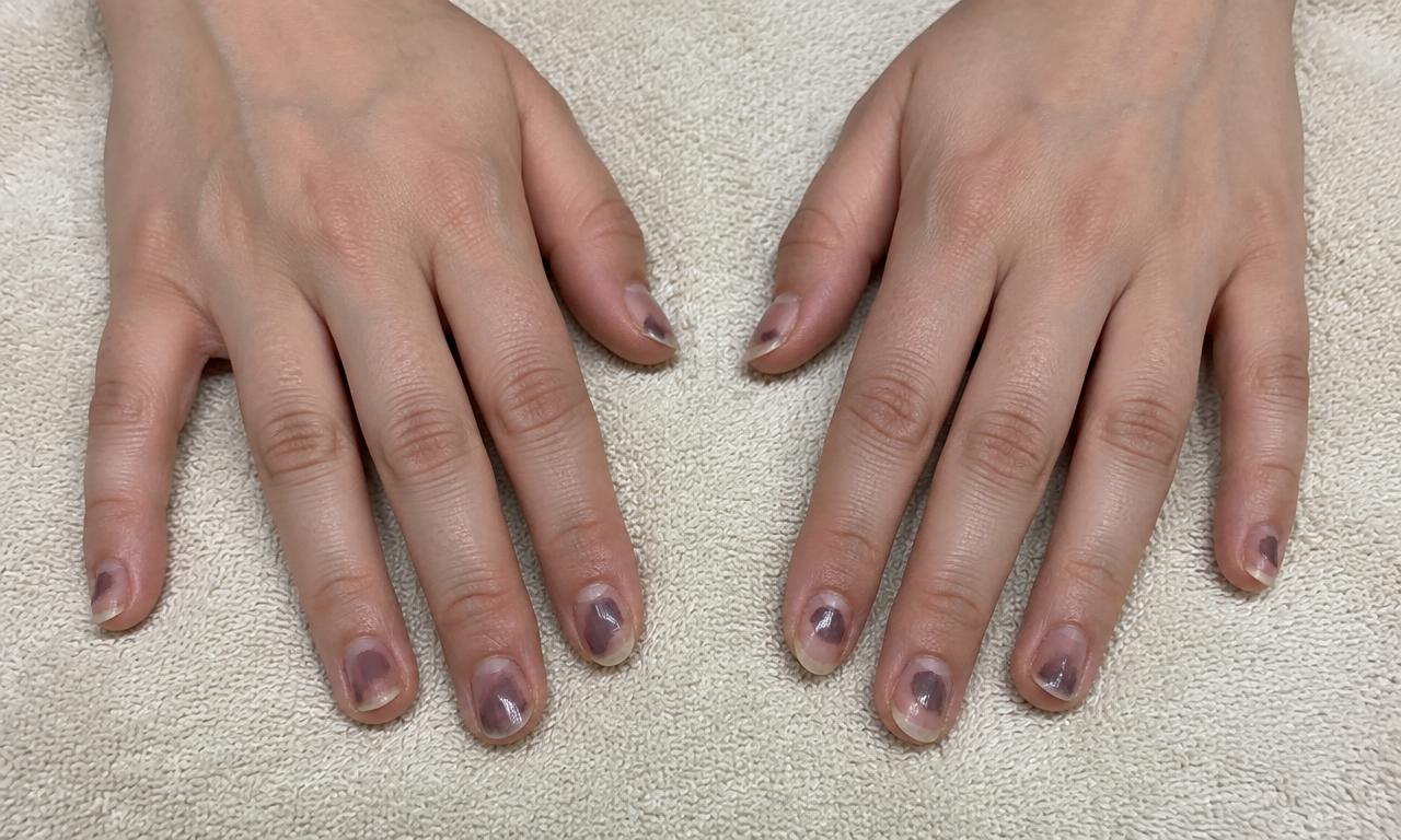 Nails before gel manicure